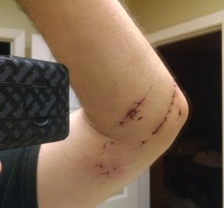 Dog bite heal.jpg