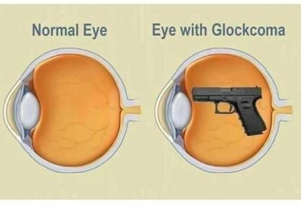 Glockoma.jpeg