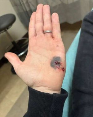 G44 AD into hand 1.jpg